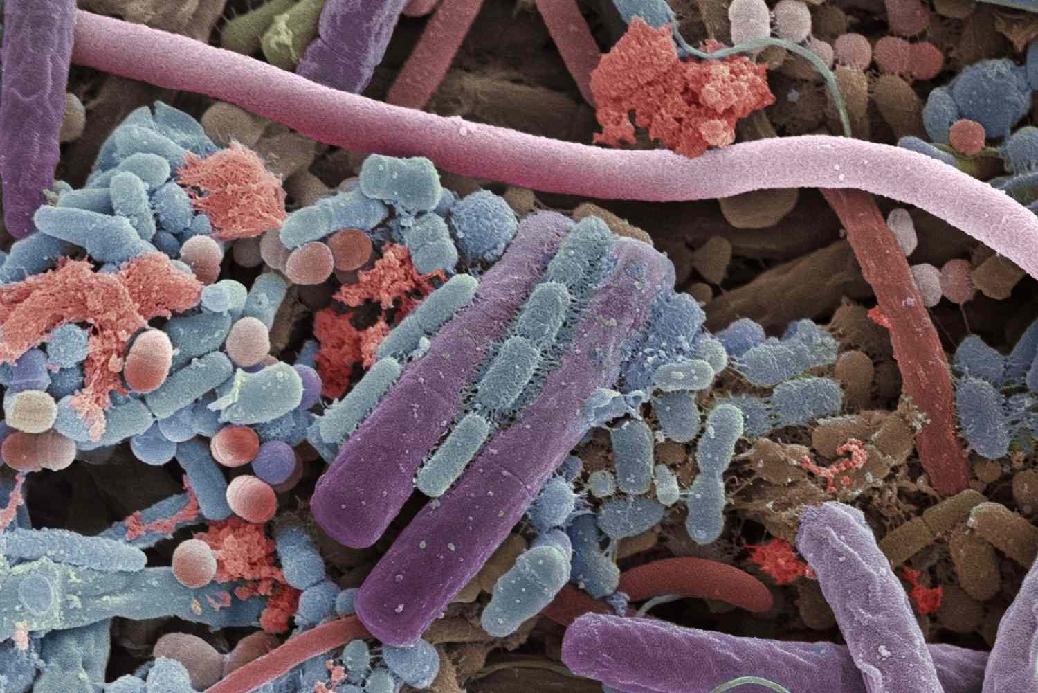 (22) Creația perfectă a lui Dumnezeu (otravă, viruși, bacterii, boli)?