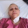 Elena luptă cu CANCERUL ovarian care a recidivat!